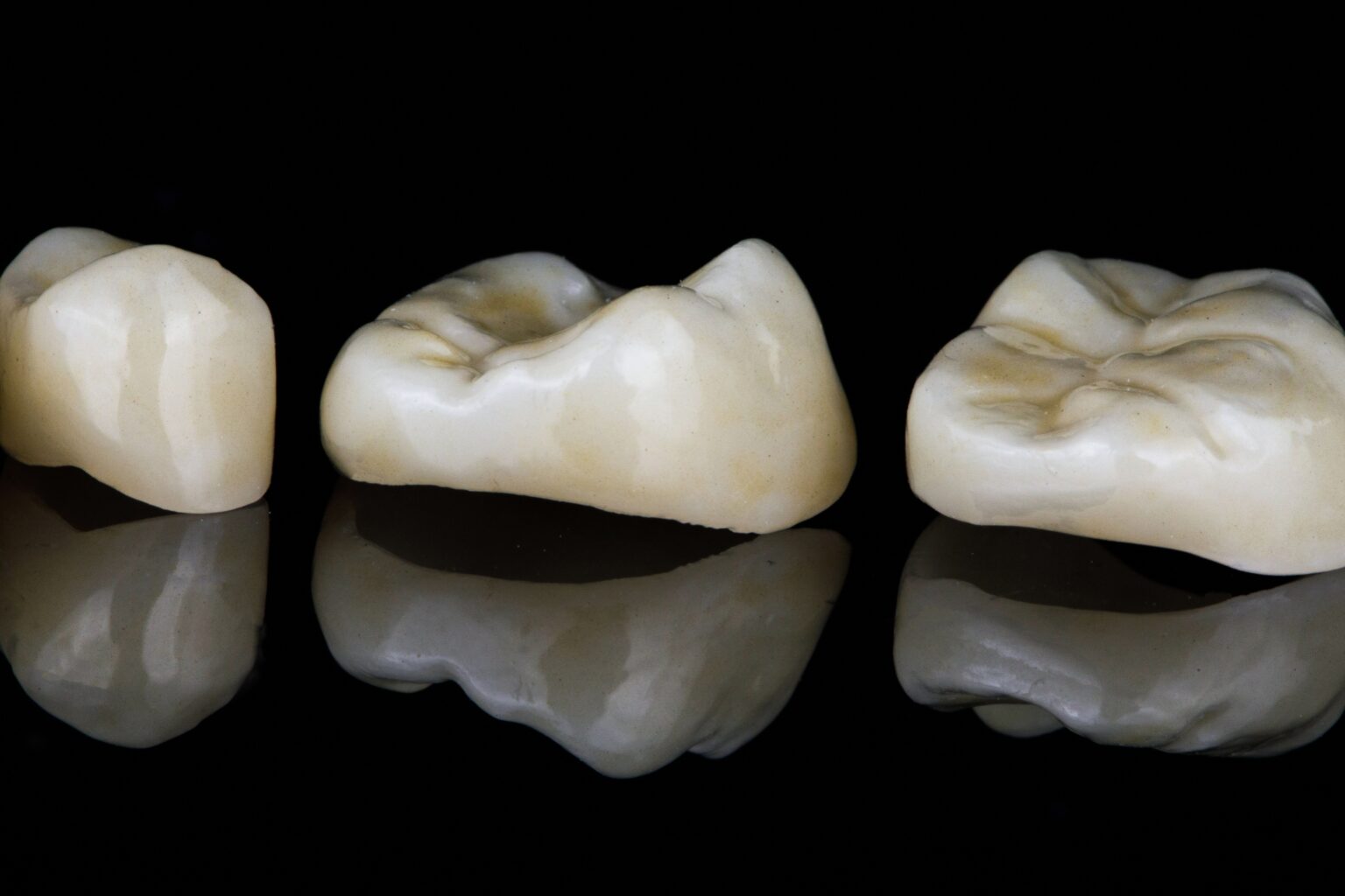 Custom Inlays & Onlays in Denver | Koman Dental Denver